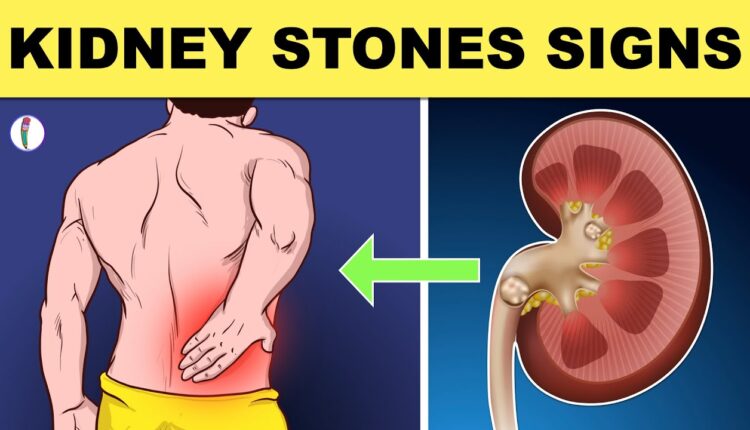 العلامات الأولى لاصابتك بالفشل الكلوي.